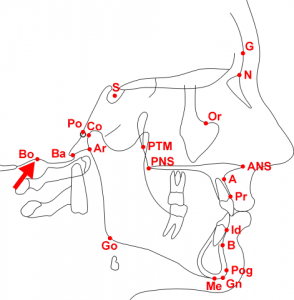 Cephalometric Analysis - Bolton (Bo)