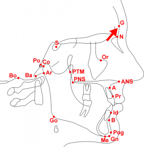 Glabella (G)