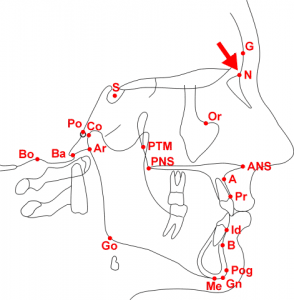 Cephalometric Analysis Analysis
