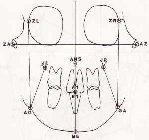Cephalometric Analysis - Ricketts Frontal Anatomy 2