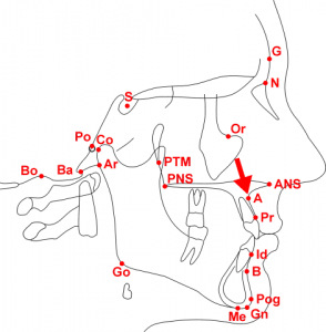 cephalometric - A-POINT 