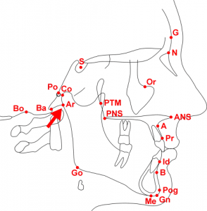 Cephalometric Analysis - Articulare (Ar)