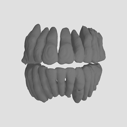 Teeth-Segmentation_CephX_after1