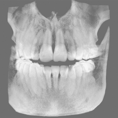 Teeth-Segmentation_CephX_before