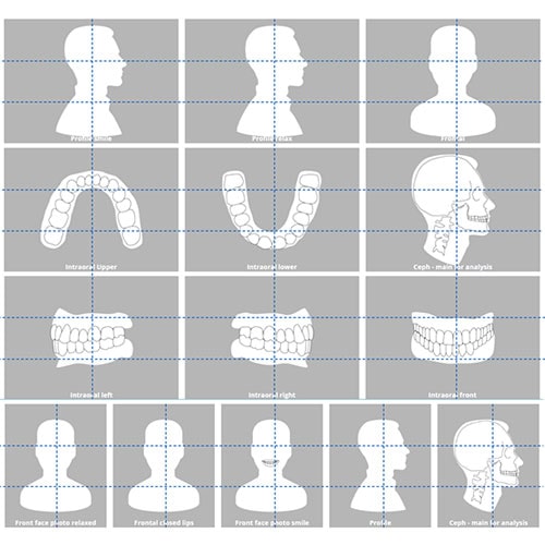 CBCT