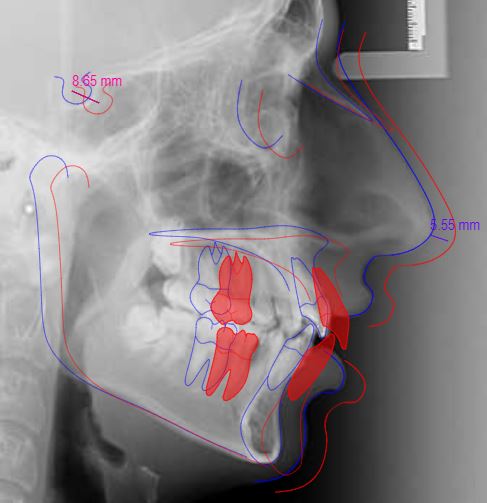 CBCT