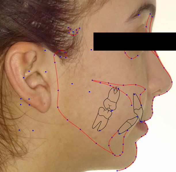 CBCT