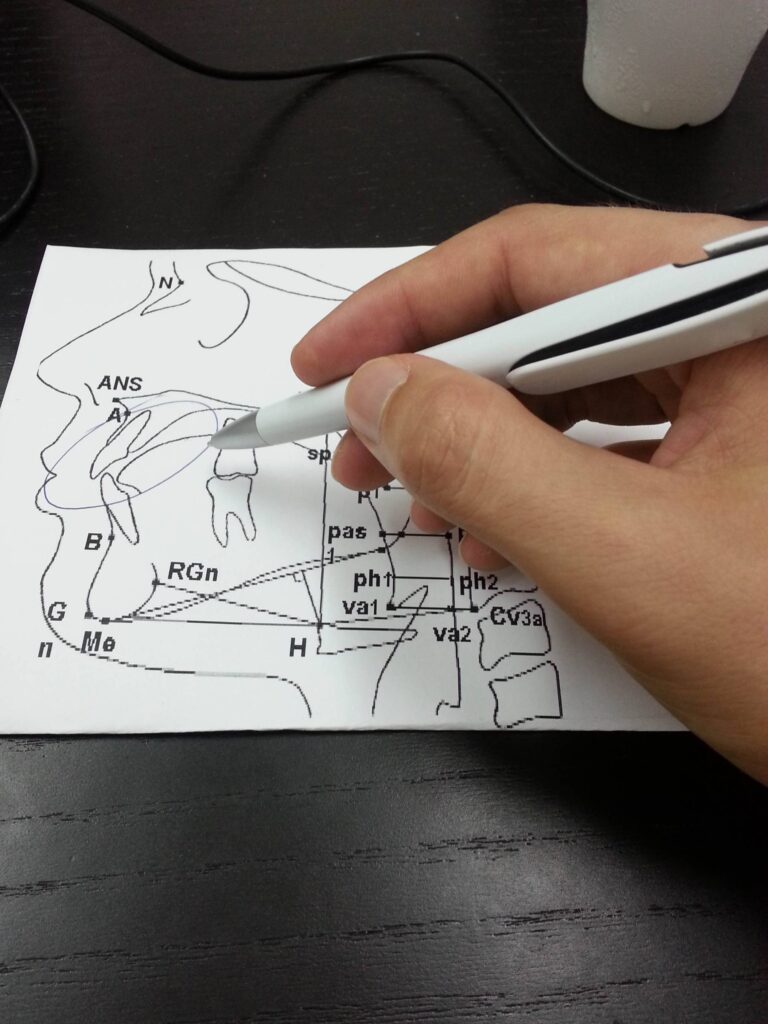 cephalometric analysis